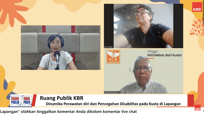 Cara Perawatan dan Penanganan Penyakit Kusta