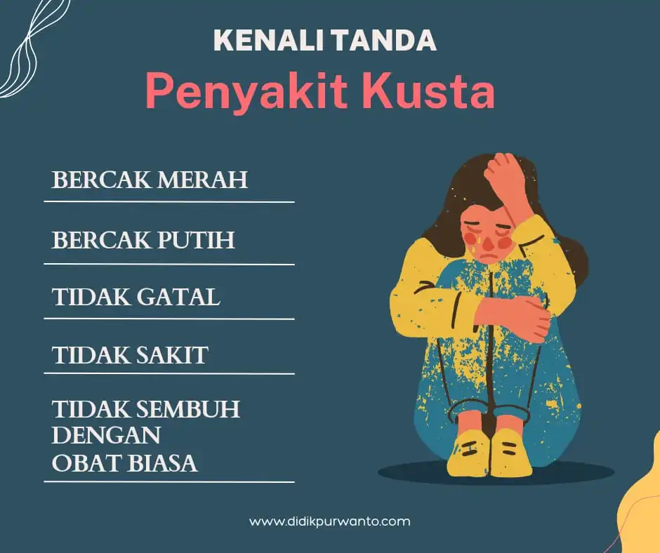 kenali tanda penyakit kusta